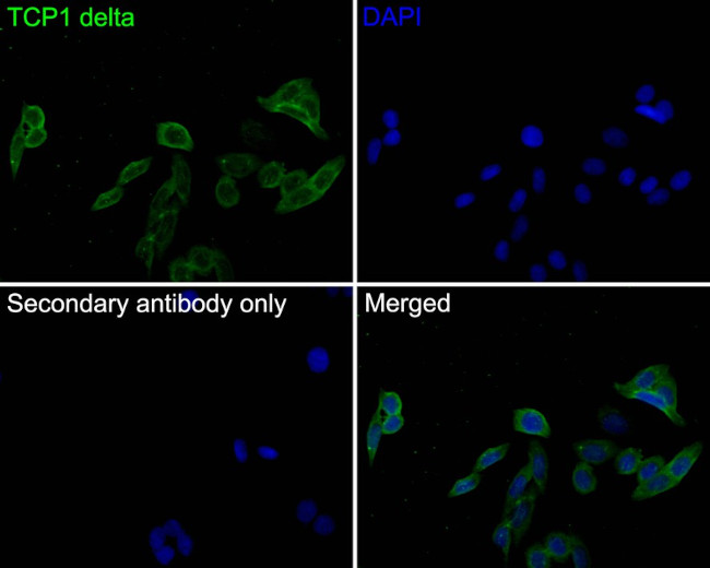 TCP1 delta Antibody in Immunocytochemistry (ICC/IF)