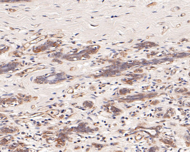 TCP1 delta Antibody in Immunohistochemistry (Paraffin) (IHC (P))