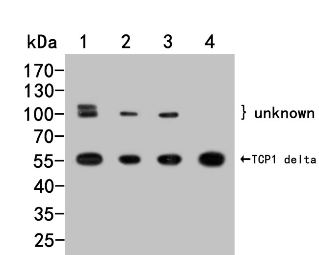 TCP1 delta Antibody in Western Blot (WB)