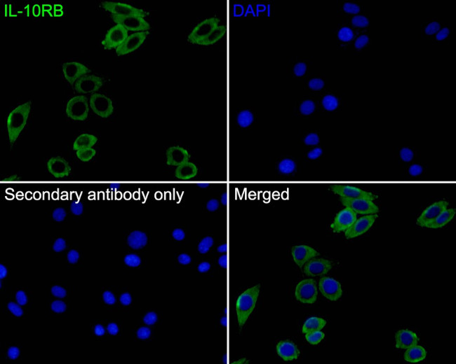 IL-10RB Antibody in Immunocytochemistry (ICC/IF)