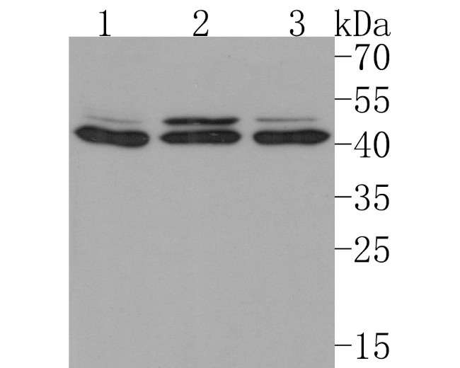 IL-10RB Antibody in Western Blot (WB)