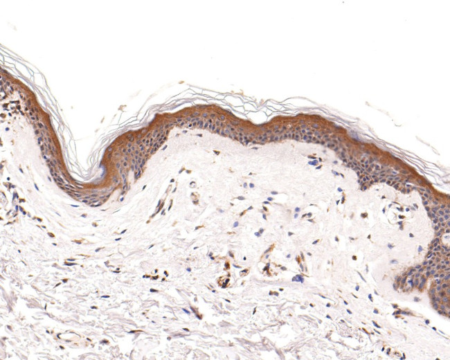 LAMB3 Antibody in Immunohistochemistry (Paraffin) (IHC (P))