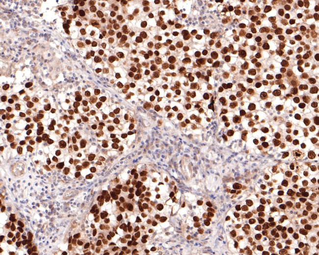 Sall4 Antibody in Immunohistochemistry (Paraffin) (IHC (P))