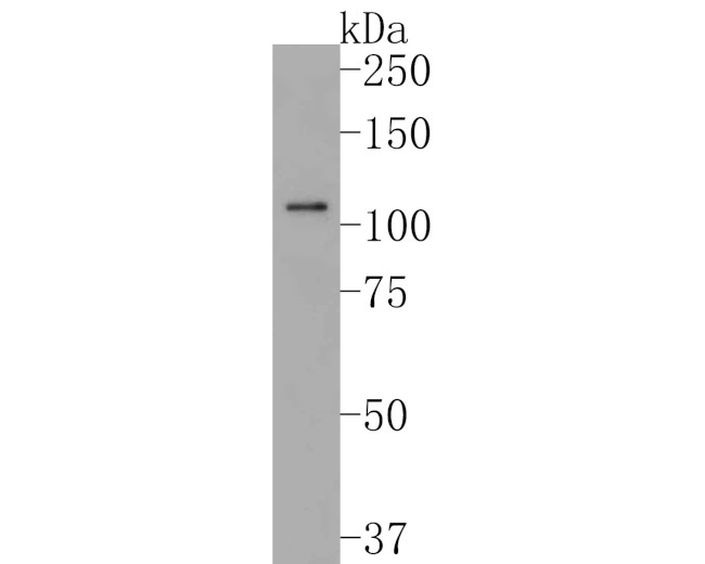 Sall4 Antibody in Western Blot (WB)