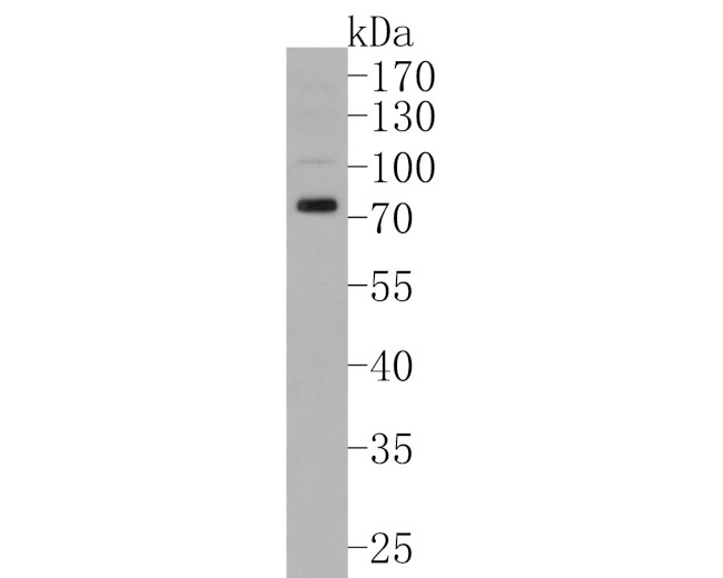 VGluT1 Antibody in Western Blot (WB)