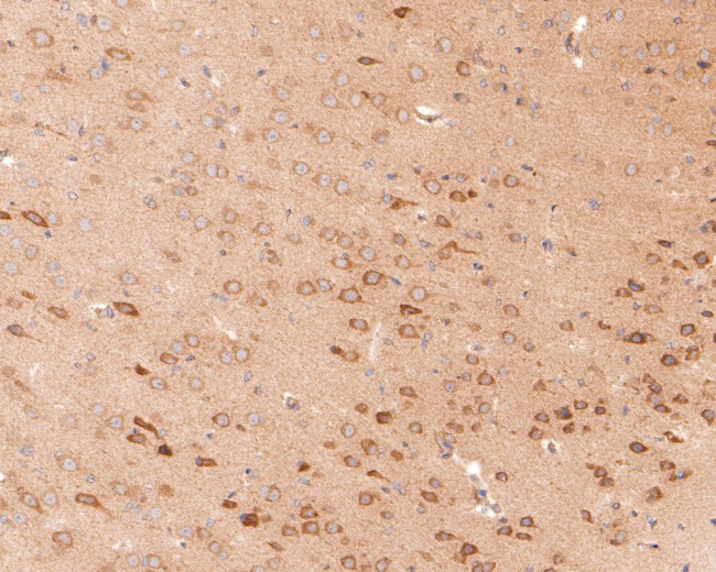 KCNIP2 Antibody in Immunohistochemistry (Paraffin) (IHC (P))