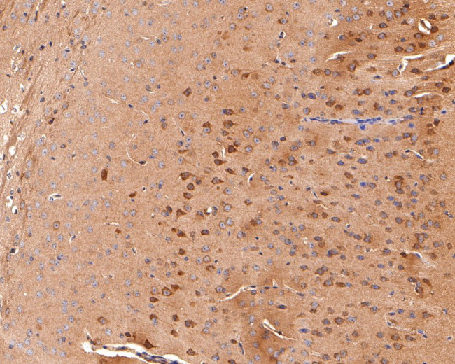 KCNIP2 Antibody in Immunohistochemistry (Paraffin) (IHC (P))