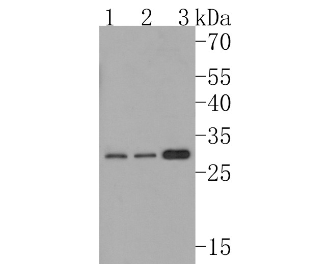 KCNIP2 Antibody in Western Blot (WB)