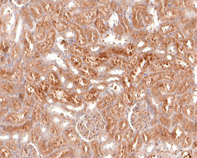 USP15 Antibody in Immunohistochemistry (Paraffin) (IHC (P))