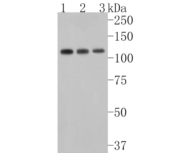 USP15 Antibody in Western Blot (WB)