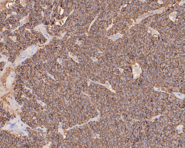 Chromogranin A Antibody in Immunohistochemistry (Paraffin) (IHC (P))