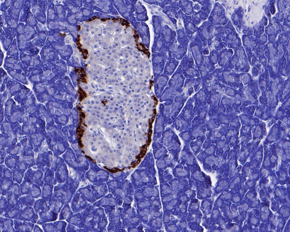 Chromogranin A Antibody in Immunohistochemistry (Paraffin) (IHC (P))