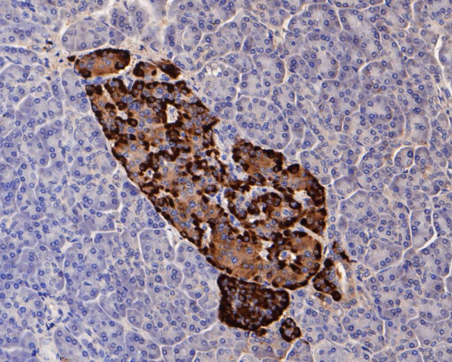 Chromogranin A Antibody in Immunohistochemistry (Paraffin) (IHC (P))