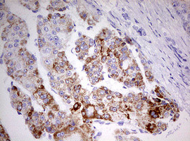 HADH Antibody in Immunohistochemistry (Paraffin) (IHC (P))