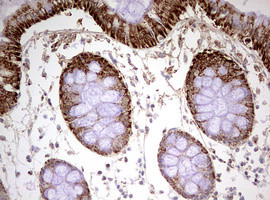 HADH Antibody in Immunohistochemistry (Paraffin) (IHC (P))