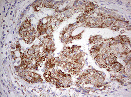 HADH Antibody in Immunohistochemistry (Paraffin) (IHC (P))