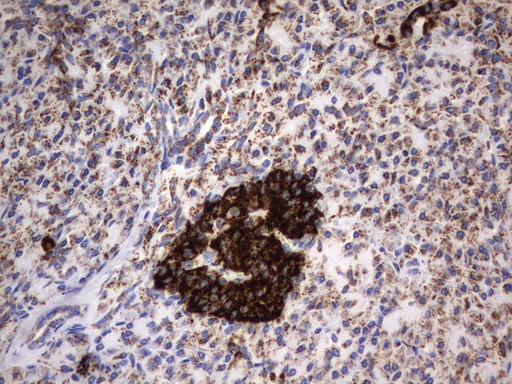 HADH Antibody in Immunohistochemistry (Paraffin) (IHC (P))