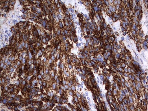 HADH Antibody in Immunohistochemistry (Paraffin) (IHC (P))