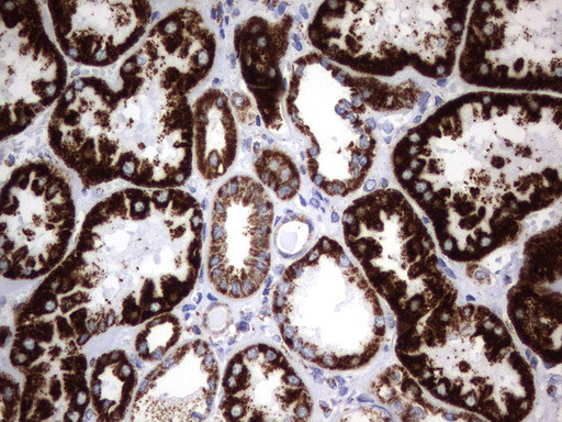 HADH Antibody in Immunohistochemistry (Paraffin) (IHC (P))