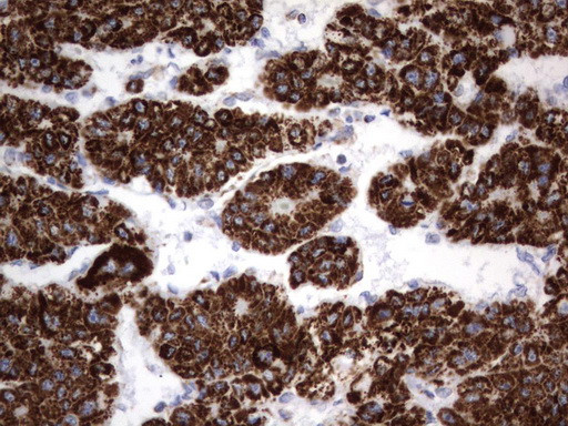 HADH Antibody in Immunohistochemistry (Paraffin) (IHC (P))