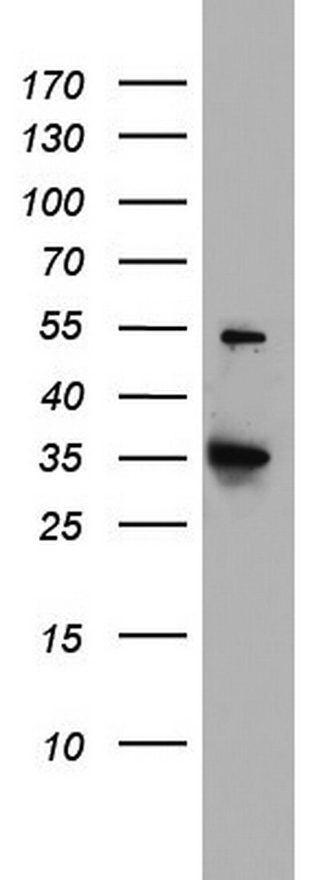 HADH Antibody in Western Blot (WB)