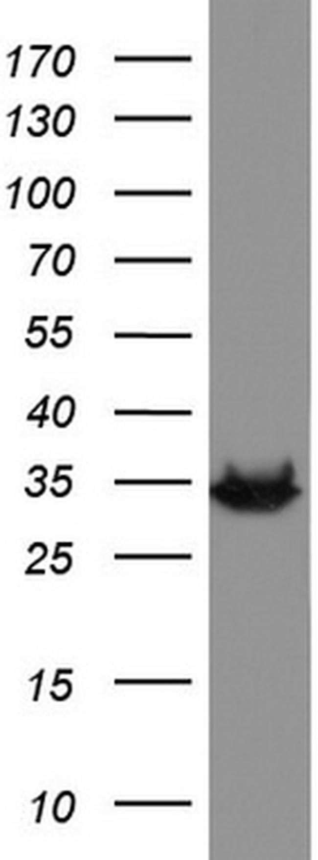 HADH Antibody in Western Blot (WB)