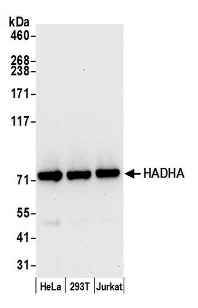 HADHA Antibody in Western Blot (WB)