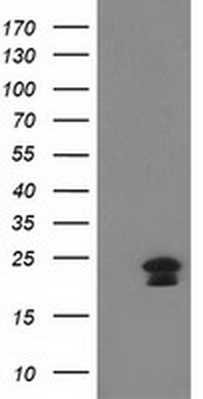HAND1 Antibody in Western Blot (WB)