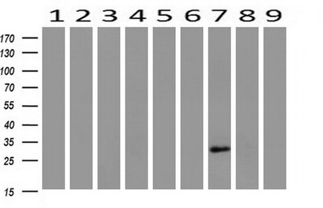 HAND1 Antibody in Western Blot (WB)