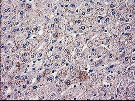 HAO1 Antibody in Immunohistochemistry (Paraffin) (IHC (P))