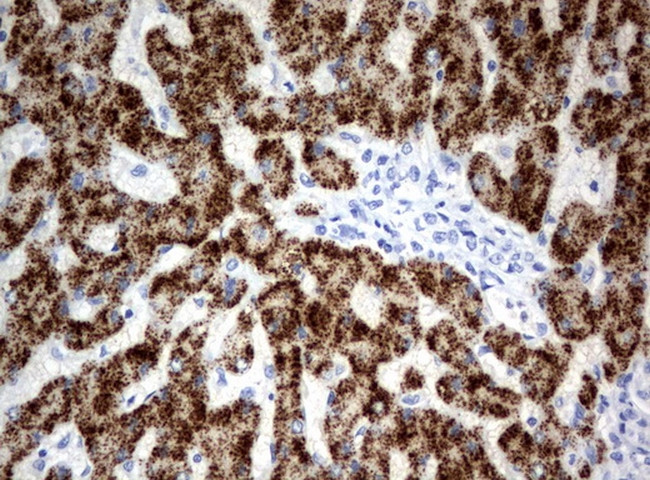 HAO1 Antibody in Immunohistochemistry (Paraffin) (IHC (P))