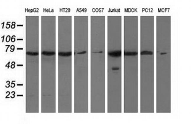 HAO1 Antibody in Western Blot (WB)