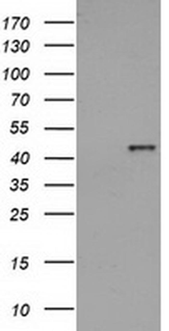 HAO1 Antibody in Western Blot (WB)
