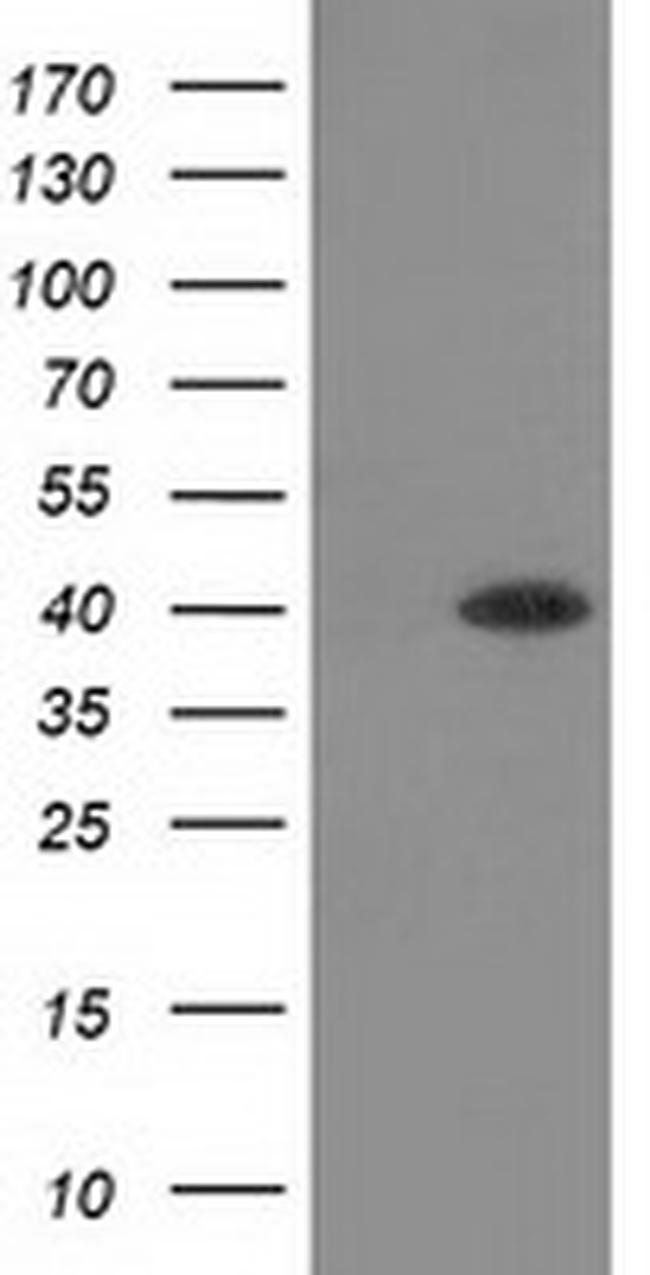 HAO1 Antibody in Western Blot (WB)