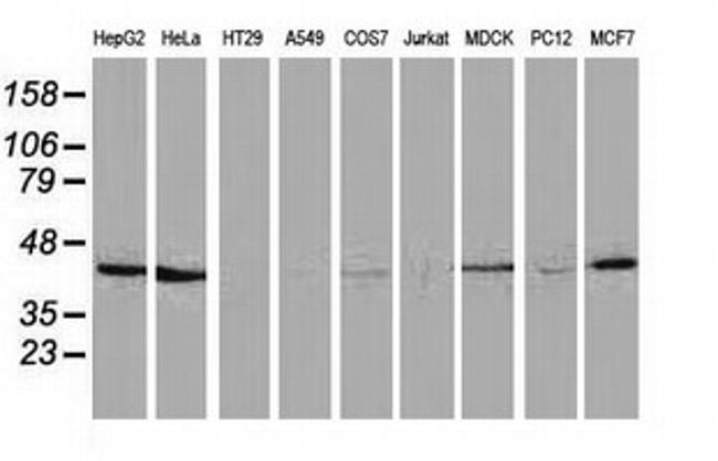 HAO1 Antibody in Western Blot (WB)