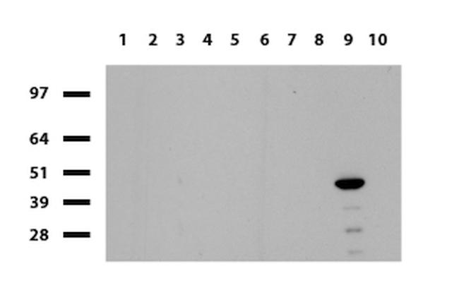 HAO1 Antibody in Western Blot (WB)