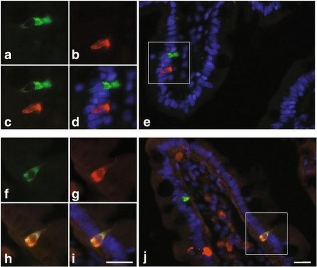 HAP1 Antibody in Immunohistochemistry (Paraffin) (IHC (P))