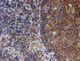 HARS2 Antibody in Immunohistochemistry (Paraffin) (IHC (P))