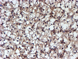 HARS2 Antibody in Immunohistochemistry (Paraffin) (IHC (P))