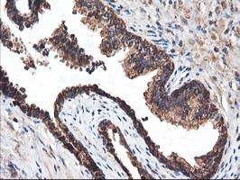 HARS2 Antibody in Immunohistochemistry (Paraffin) (IHC (P))