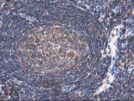 HARS2 Antibody in Immunohistochemistry (Paraffin) (IHC (P))