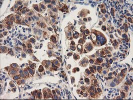 HARS2 Antibody in Immunohistochemistry (Paraffin) (IHC (P))