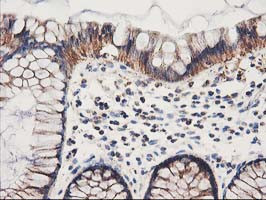 HARS2 Antibody in Immunohistochemistry (Paraffin) (IHC (P))