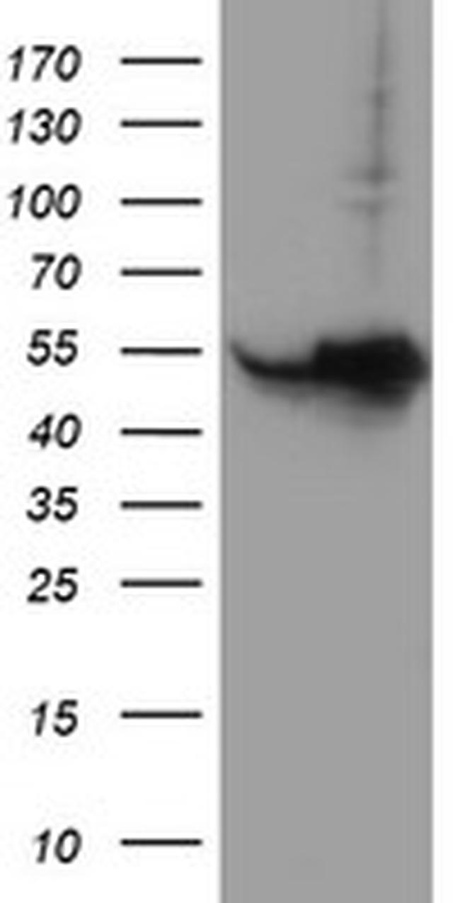 HARS2 Antibody in Western Blot (WB)