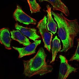 HAS2 Antibody in Immunocytochemistry (ICC/IF)