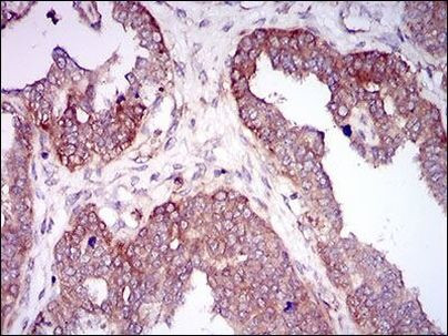 HAS2 Antibody in Immunohistochemistry (Paraffin) (IHC (P))