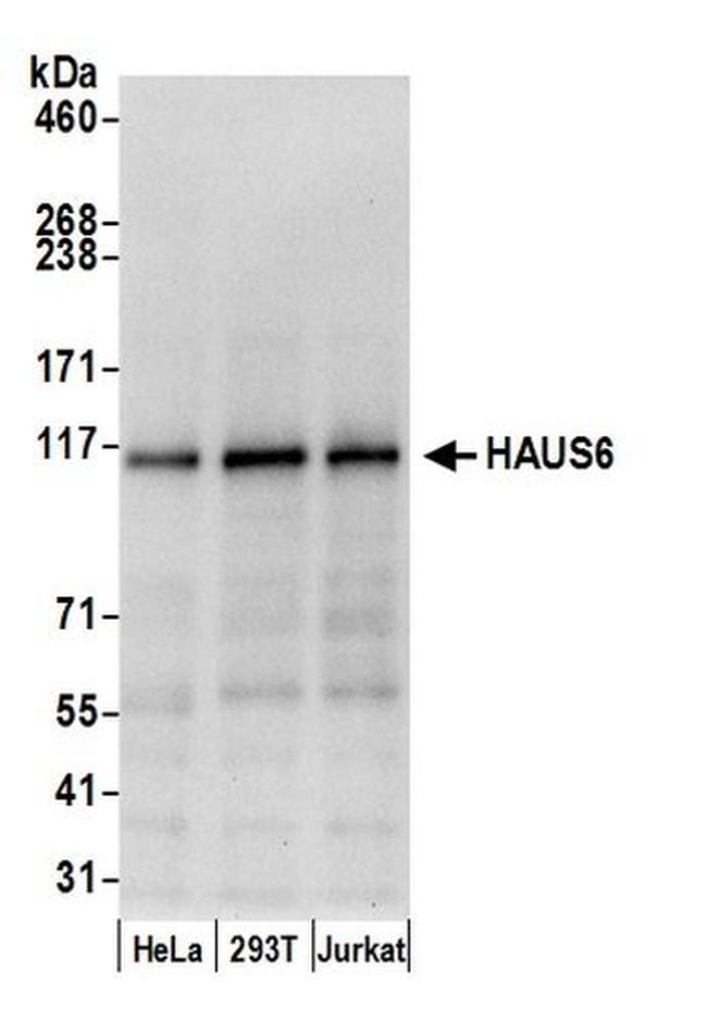 HAUS6 Antibody in Western Blot (WB)