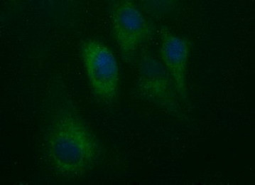 HAUS7 Antibody in Immunocytochemistry (ICC/IF)