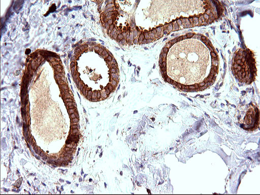 HAUS7 Antibody in Immunohistochemistry (Paraffin) (IHC (P))