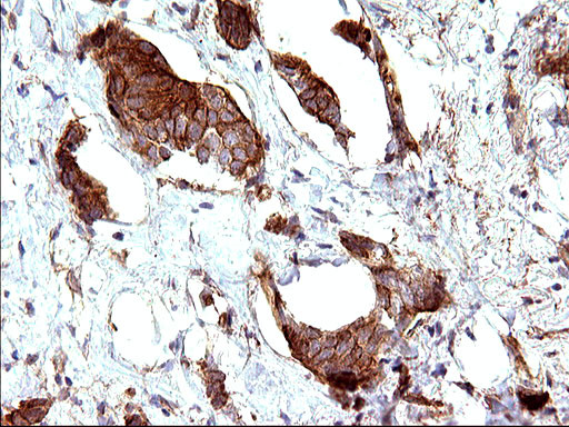 HAUS7 Antibody in Immunohistochemistry (Paraffin) (IHC (P))